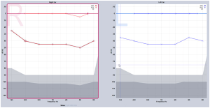 Hearing loss graph 